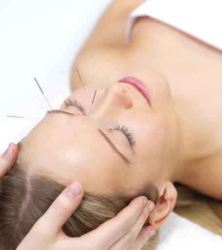 Acupuncture Will Help Ido Holistic Center
